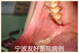 叶某治疗后.jpg