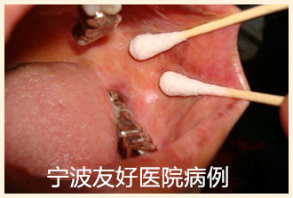 许某治疗后.jpg