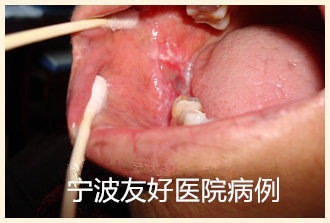杜某治疗前.jpg