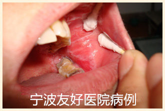 符某治疗前.jpg