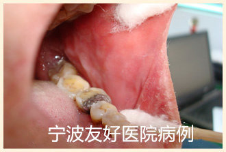 符某治疗后.jpg