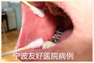 张某治疗后.jpg
