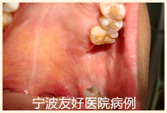 韦某南京人治疗后.jpg