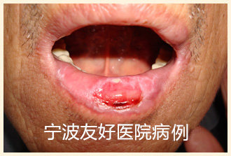 唐某治疗前.jpg