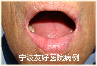 唐某治疗后.jpg